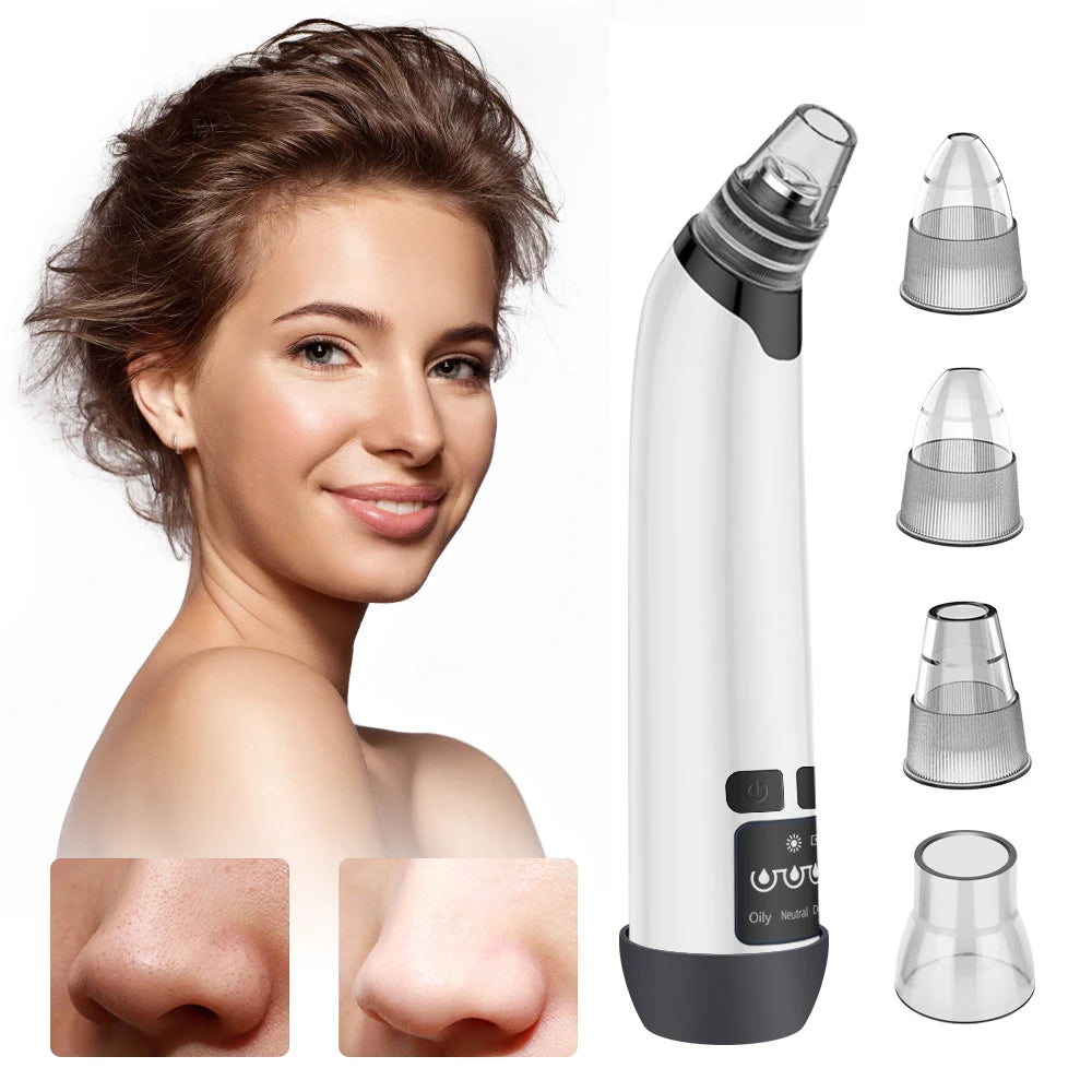 Hot Compress Blackhead Remover Vacuum Suction Acne Pore Cleaner Electric Nose Face Deep Cleansing Skin Care Device Birthday Gift