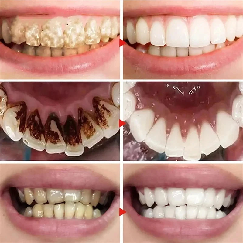 New Teeth Whitening Toothpaste 5D Teeth Whitening Stick Oral Hygiene Cleaning Teeth Whitening Tool Fresh Breath Teeth Care New