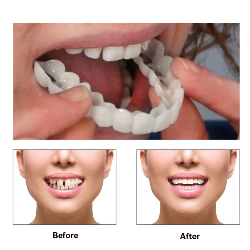 Denture Cover Veneer Snap-on Teeth Kit Fake Temporary Tooth Whitening Replacement Temporary Tooth Replacement Tooth Model