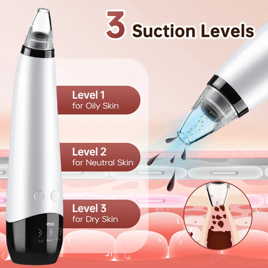 Blackhead Remover Facial Pore Cleaner 3 Suction Power Electric Pimple Acne Extractor Tool Face & Nose Whiteheads Vacuum Removal