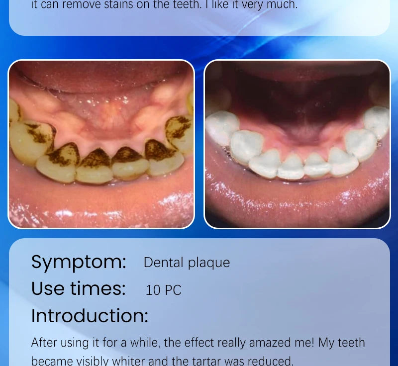 2025 New Technology Effectively Whitens Teeth and Cleansing Plaque Mineral Powder