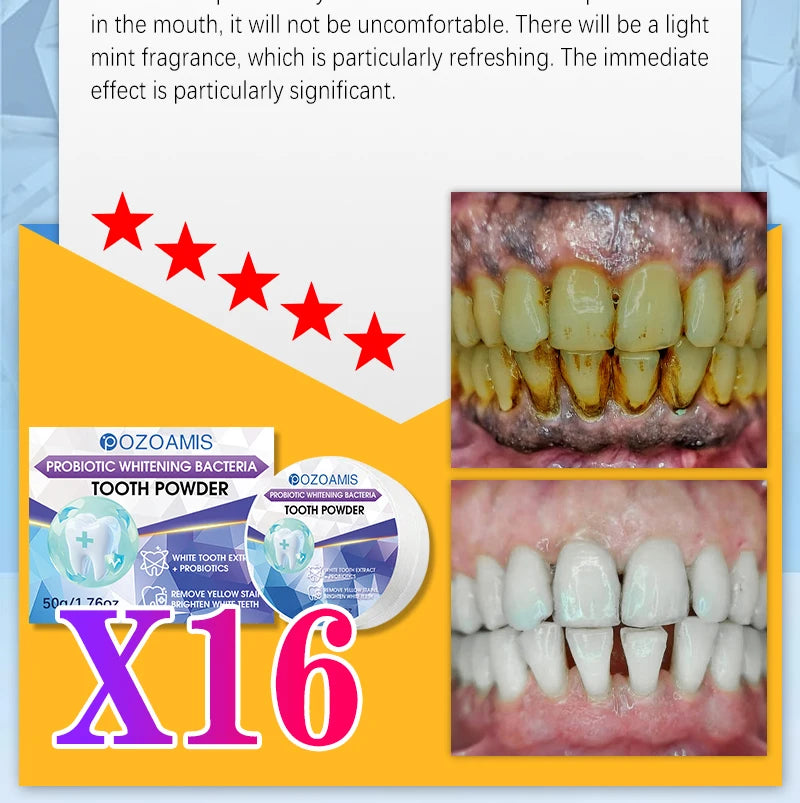 2025 New Technology Effectively Whitens Teeth and Cleansing Plaque Mineral Powder