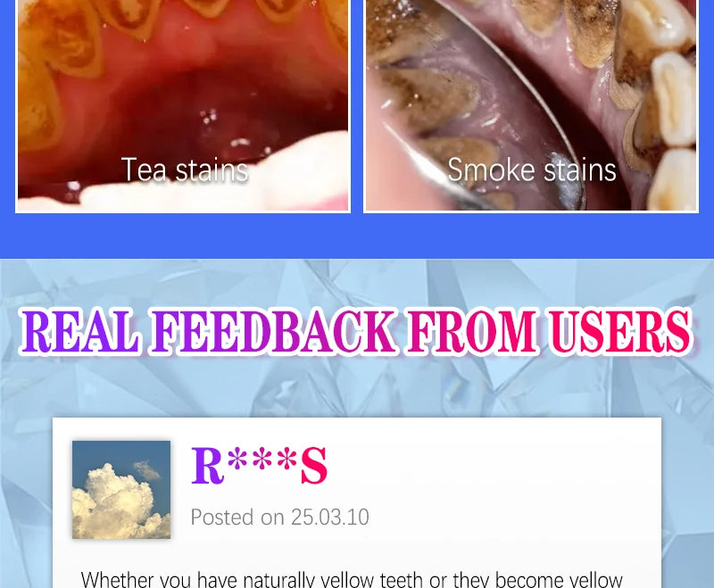 2025 New Technology Effectively Whitens Teeth and Cleansing Plaque Mineral Powder