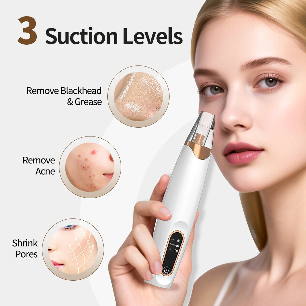Hot Compress Blackhead Remover Vacuum Suction Acne Pore Cleaner Electric Nose Face Deep Cleansing Skin Care Device Birthday Gift