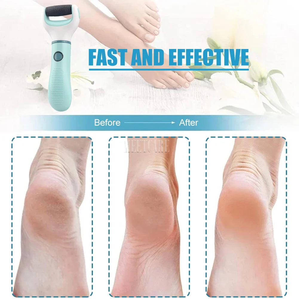 Electric Foot Grinder Dead Skin Remover Feet Scrubber Callus Pedicure Shaver Remove Dry Dead Cracked Safe Foot Care Repair