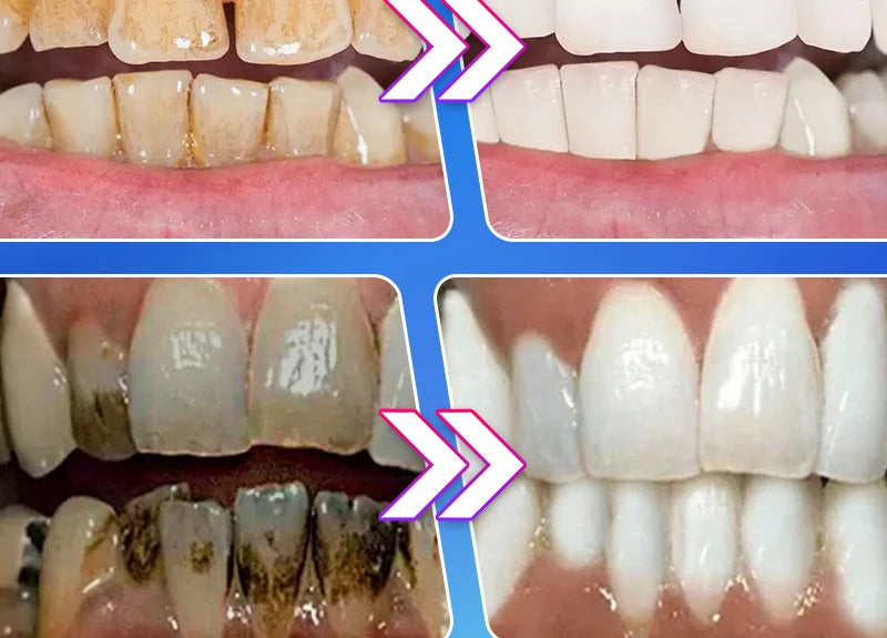 2025 New Technology Effectively Whitens Teeth and Cleansing Plaque Mineral Powder