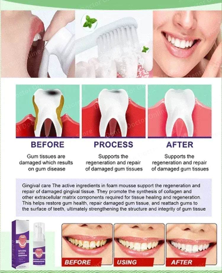 Tooth decay Repair Repair all cavities, protect teeth remove plaque stains Tooth decay repair teeth whitening Dental