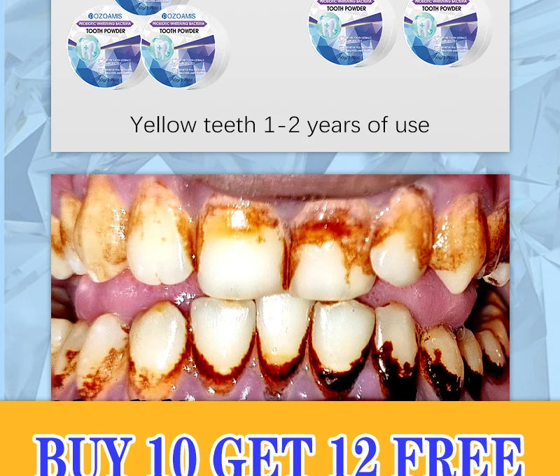 2025 New Technology Effectively Whitens Teeth and Cleansing Plaque Mineral Powder