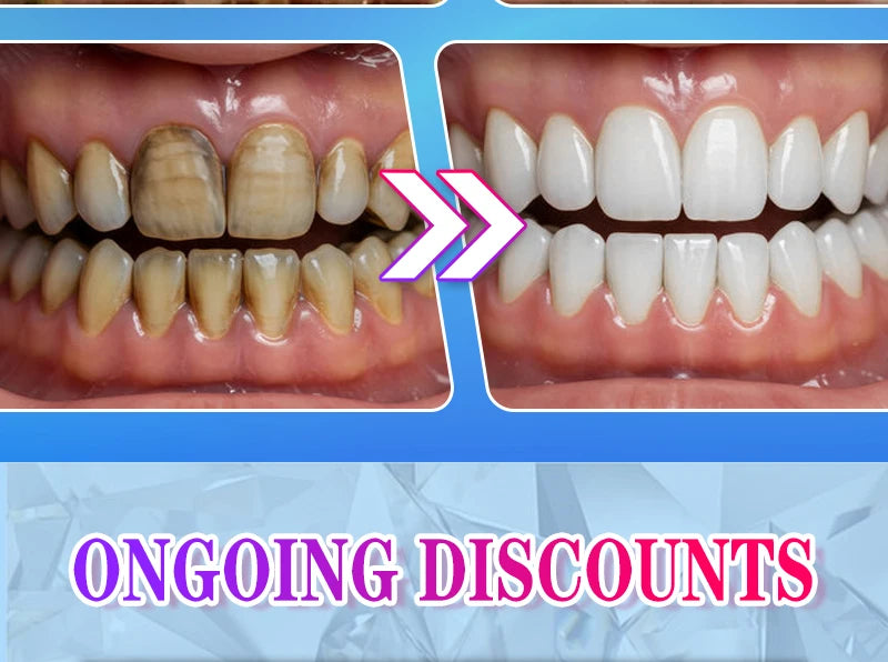 2025 New Technology Effectively Whitens Teeth and Cleansing Plaque Mineral Powder