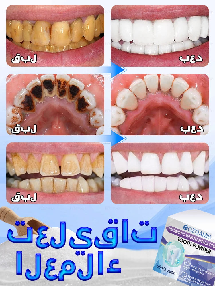 2025 New Technology Effectively Whitens Teeth and Cleansing Plaque Mineral Powder