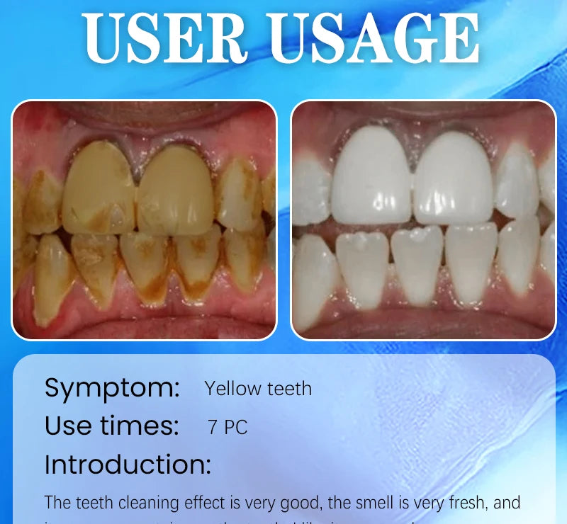 2025 New Technology Effectively Whitens Teeth and Cleansing Plaque Mineral Powder