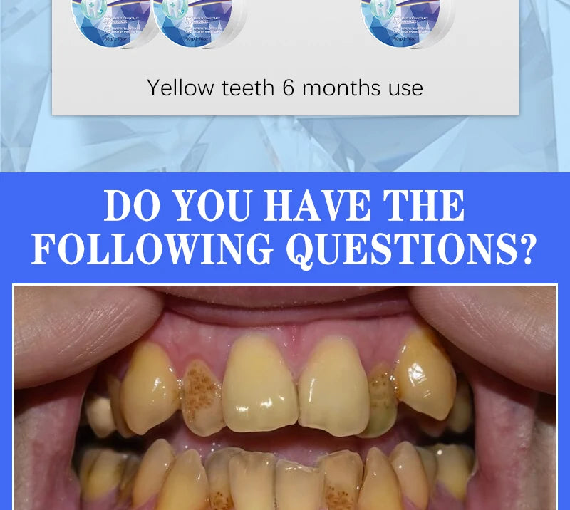 2025 New Technology Effectively Whitens Teeth and Cleansing Plaque Mineral Powder