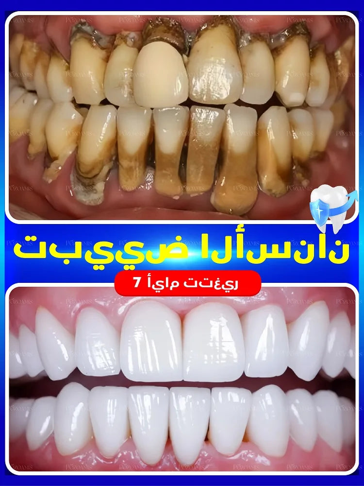 2025 New Technology Effectively Whitens Teeth and Cleansing Plaque Mineral Powder