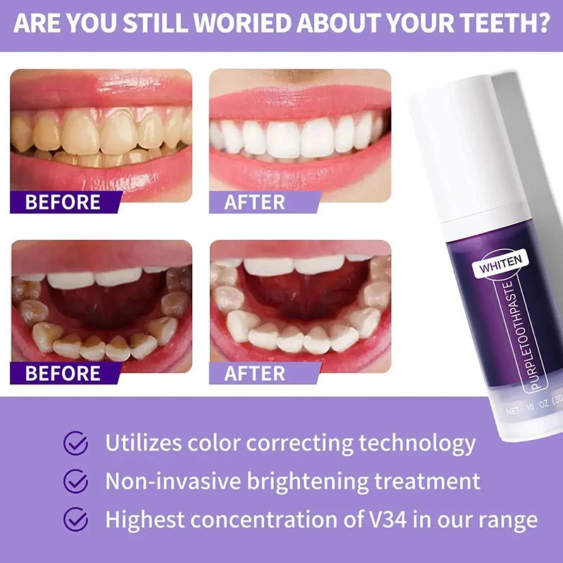 New Teeth Whitening Toothpaste 5D Teeth Whitening Stick Oral Hygiene Cleaning Teeth Whitening Tool Fresh Breath Teeth Care New