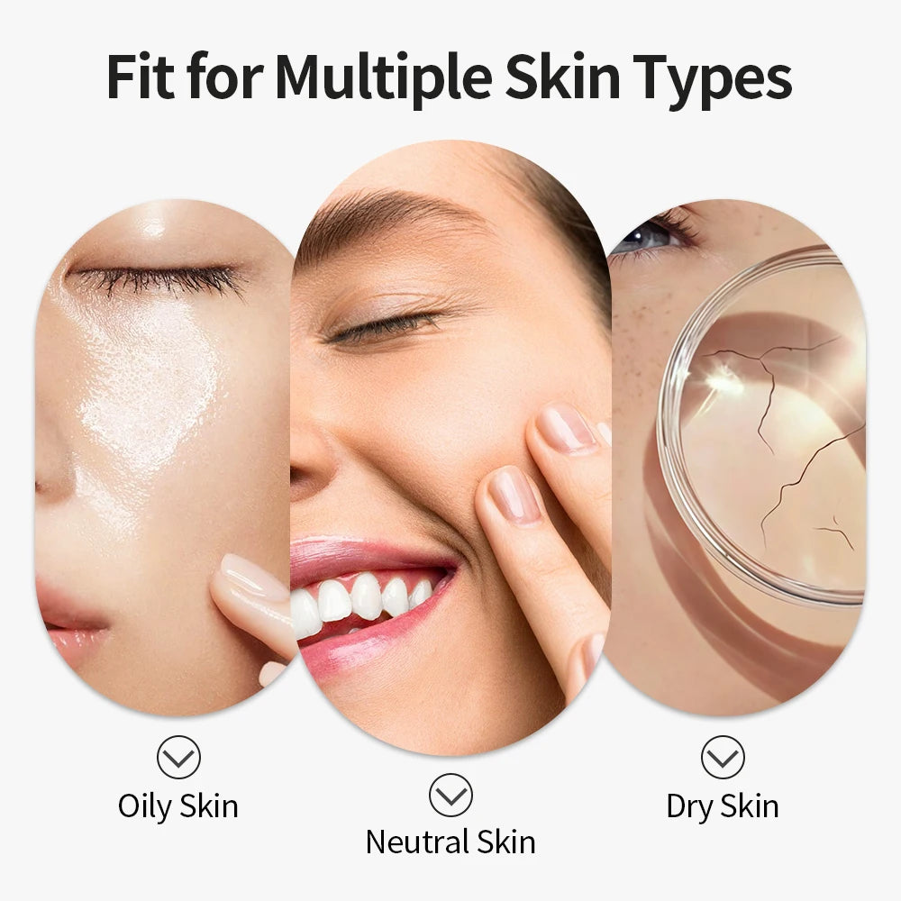 Hot Compress Blackhead Remover Vacuum Suction Acne Pore Cleaner Electric Nose Face Deep Cleansing Skin Care Device Birthday Gift