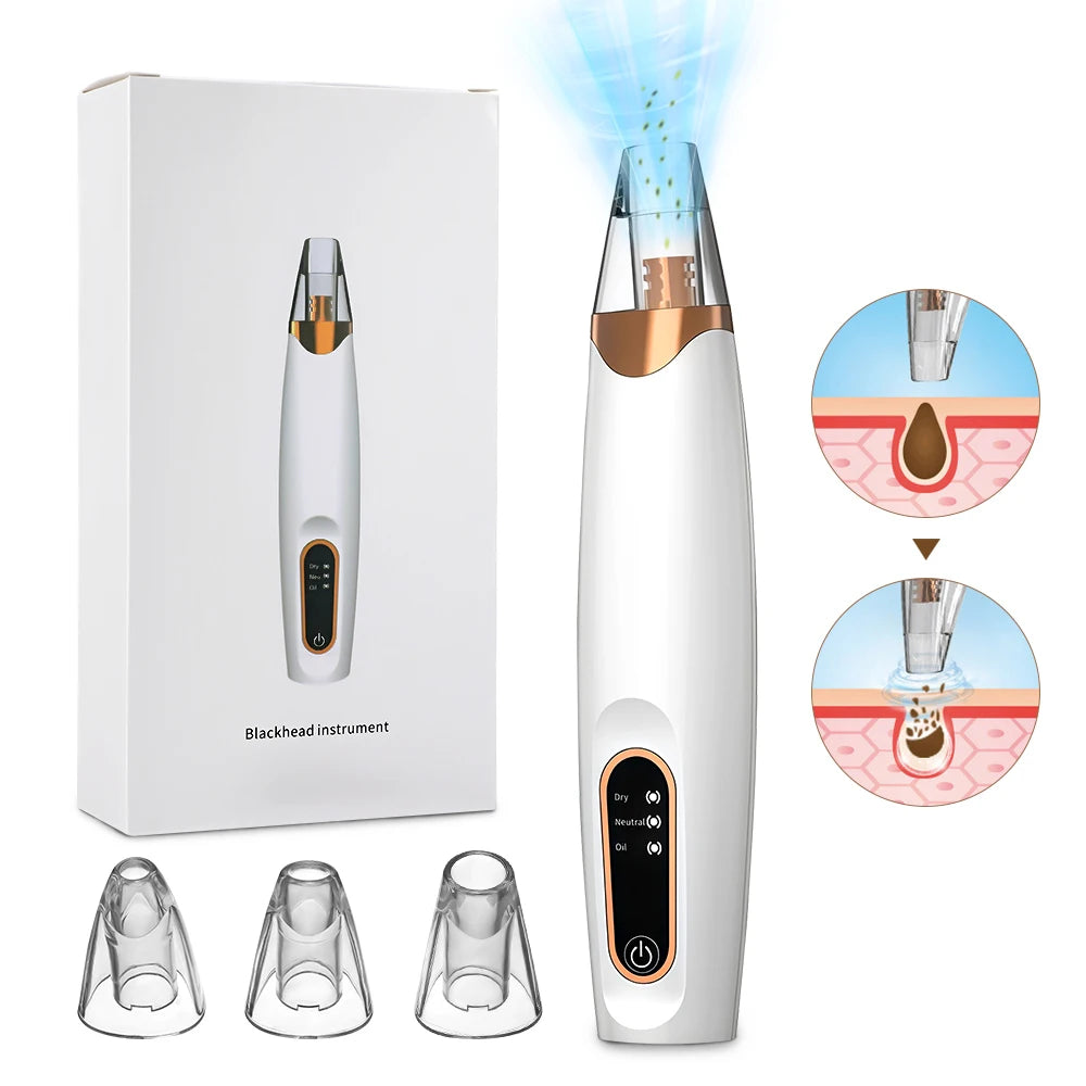 Hot Compress Blackhead Remover Vacuum Suction Acne Pore Cleaner Electric Nose Face Deep Cleansing Skin Care Device Birthday Gift