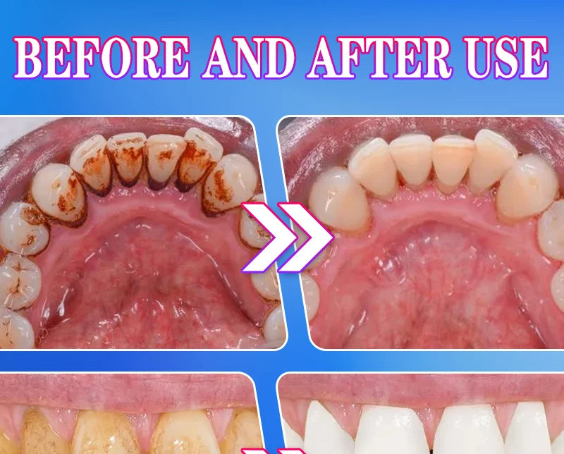 2025 New Technology Effectively Whitens Teeth and Cleansing Plaque Mineral Powder