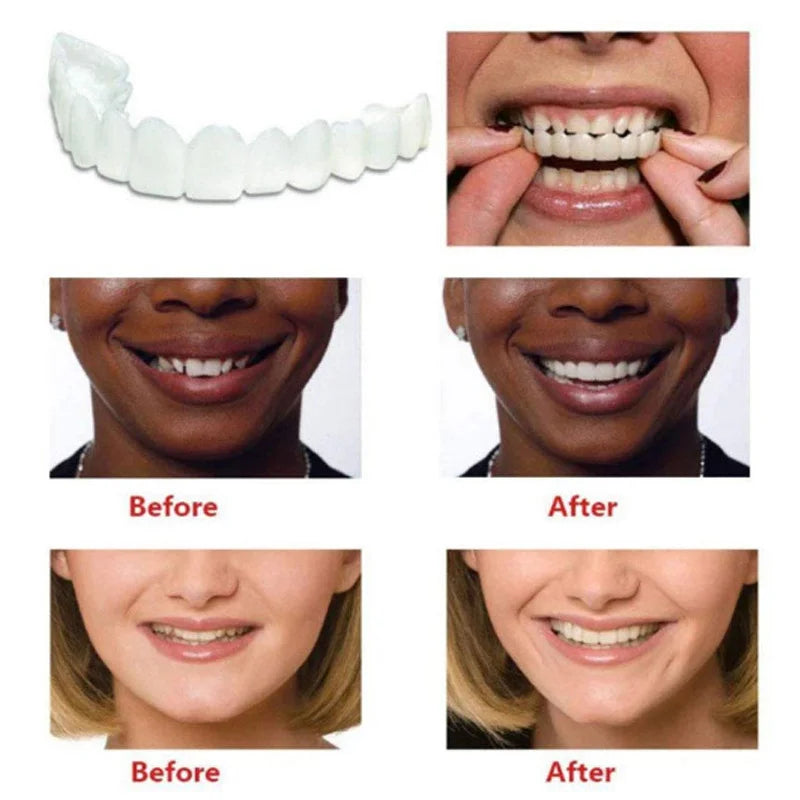 Denture Cover Veneer Snap-on Teeth Kit Fake Temporary Tooth Whitening Replacement Temporary Tooth Replacement Tooth Model