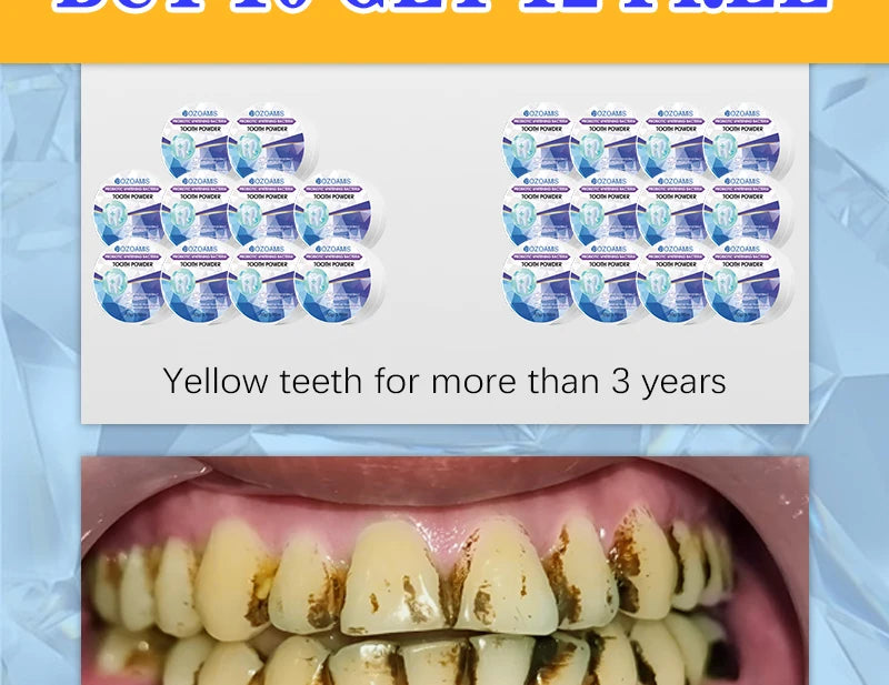 2025 New Technology Effectively Whitens Teeth and Cleansing Plaque Mineral Powder