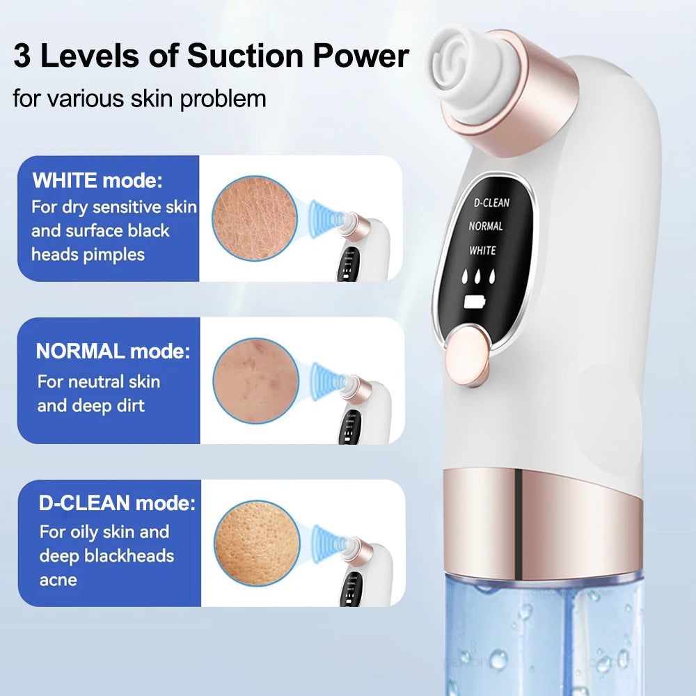 Electric Blackhead Remover Pore Vacuum Cleaner Facial Black Dots Vacuum Cleaner Pimple Acne Blackhead Removal Black Dots Remover