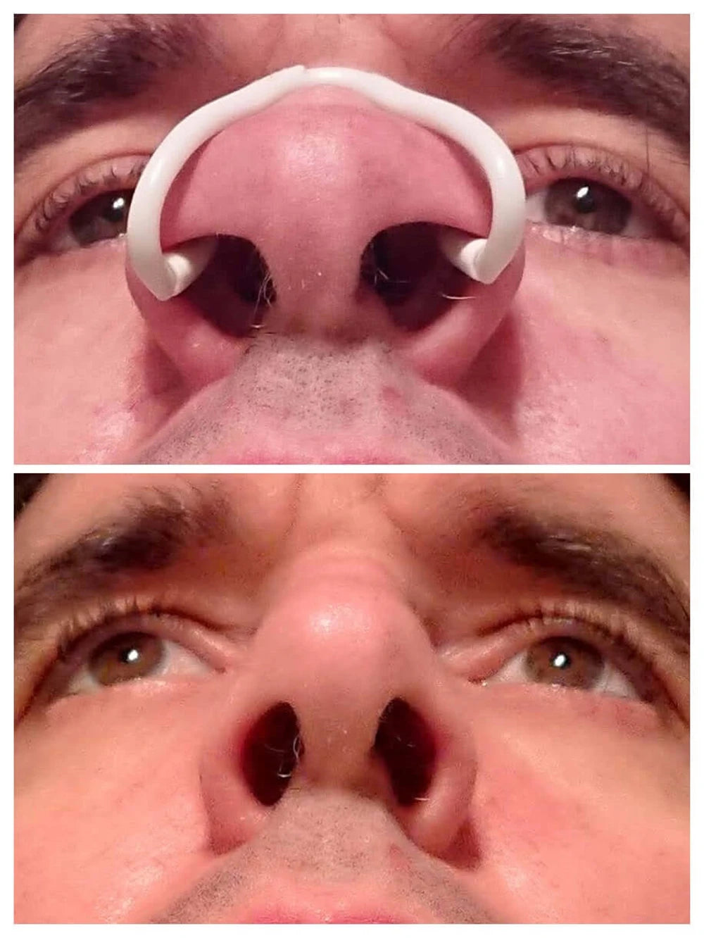 Nasal Dilator For Improve Nose Vent Ease Breathing Relieve Snore Silicone Anti Snoring Nose Clip For Better Sleep Snore Solution