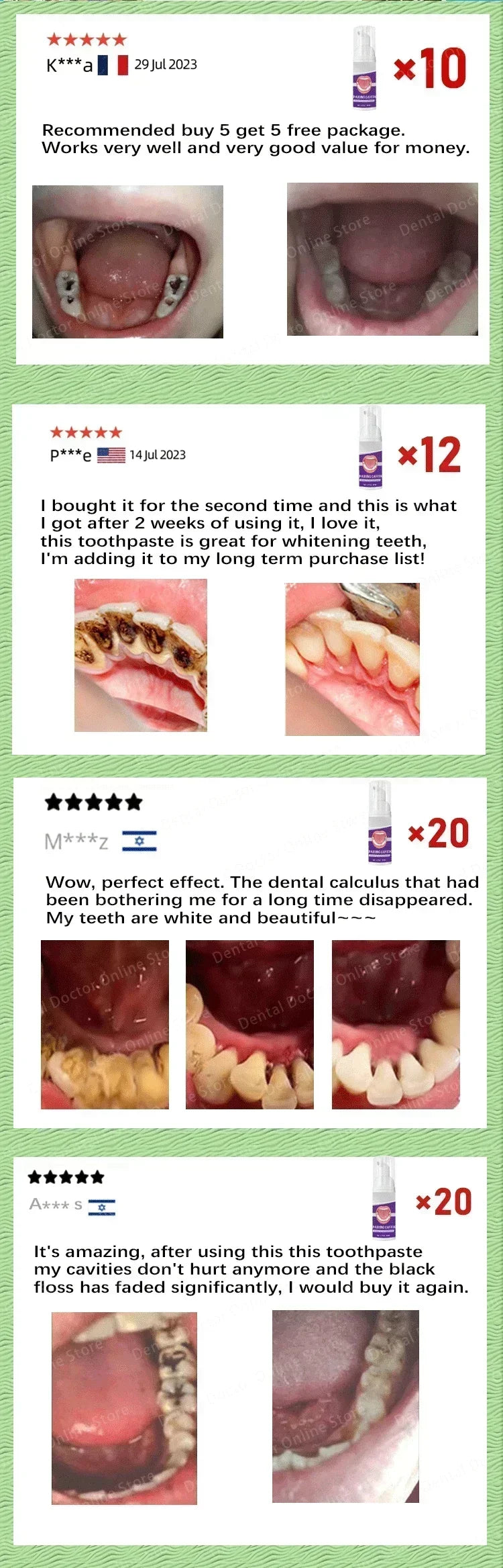Tooth decay Repair Repair all cavities, protect teeth remove plaque stains Tooth decay repair teeth whitening Dental