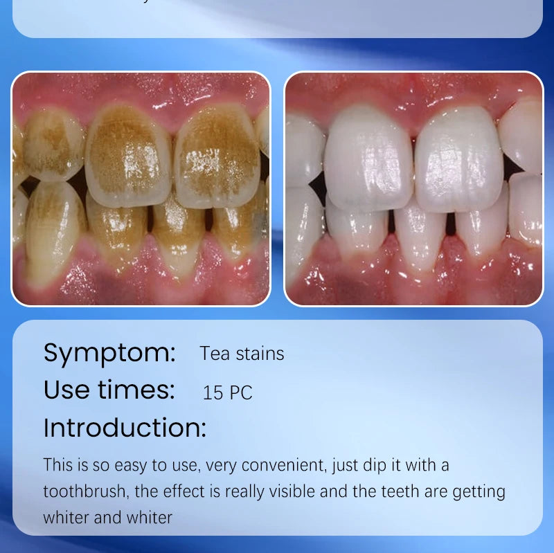 2025 New Technology Effectively Whitens Teeth and Cleansing Plaque Mineral Powder