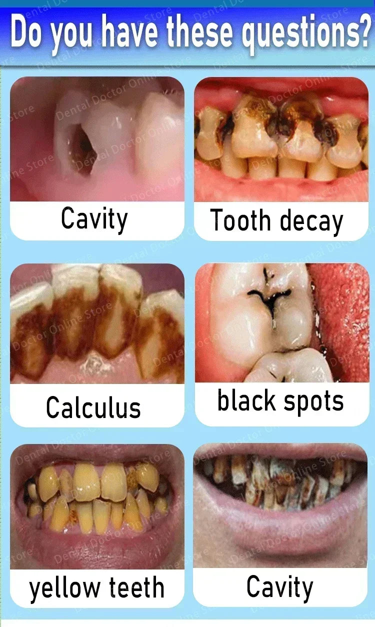 Tooth decay Repair Repair all cavities, protect teeth remove plaque stains Tooth decay repair teeth whitening Dental