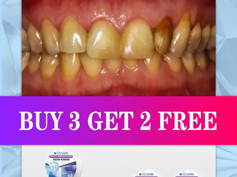 2025 New Technology Effectively Whitens Teeth and Cleansing Plaque Mineral Powder